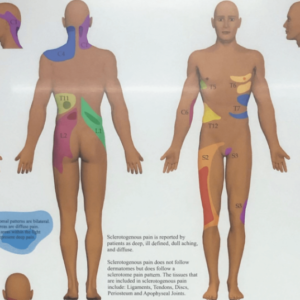 Sclerotome2 Sclerotome2