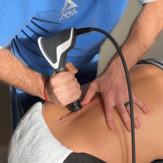 Shockwave Therapy Shockwave Therapy